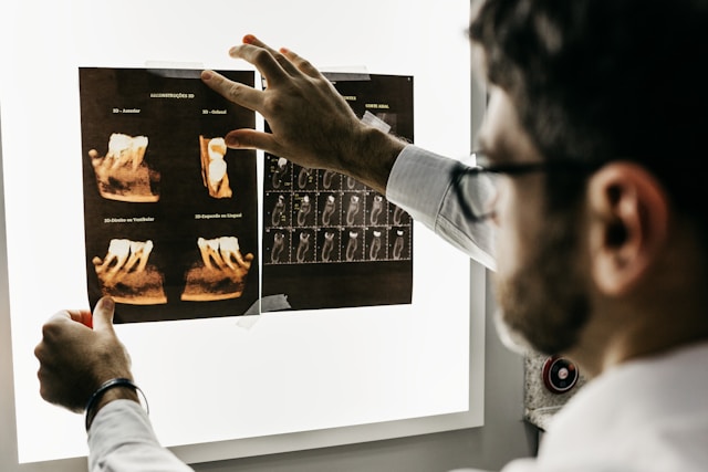 Same-Day vs Traditional Implants in Albania: Which Is Right for You?